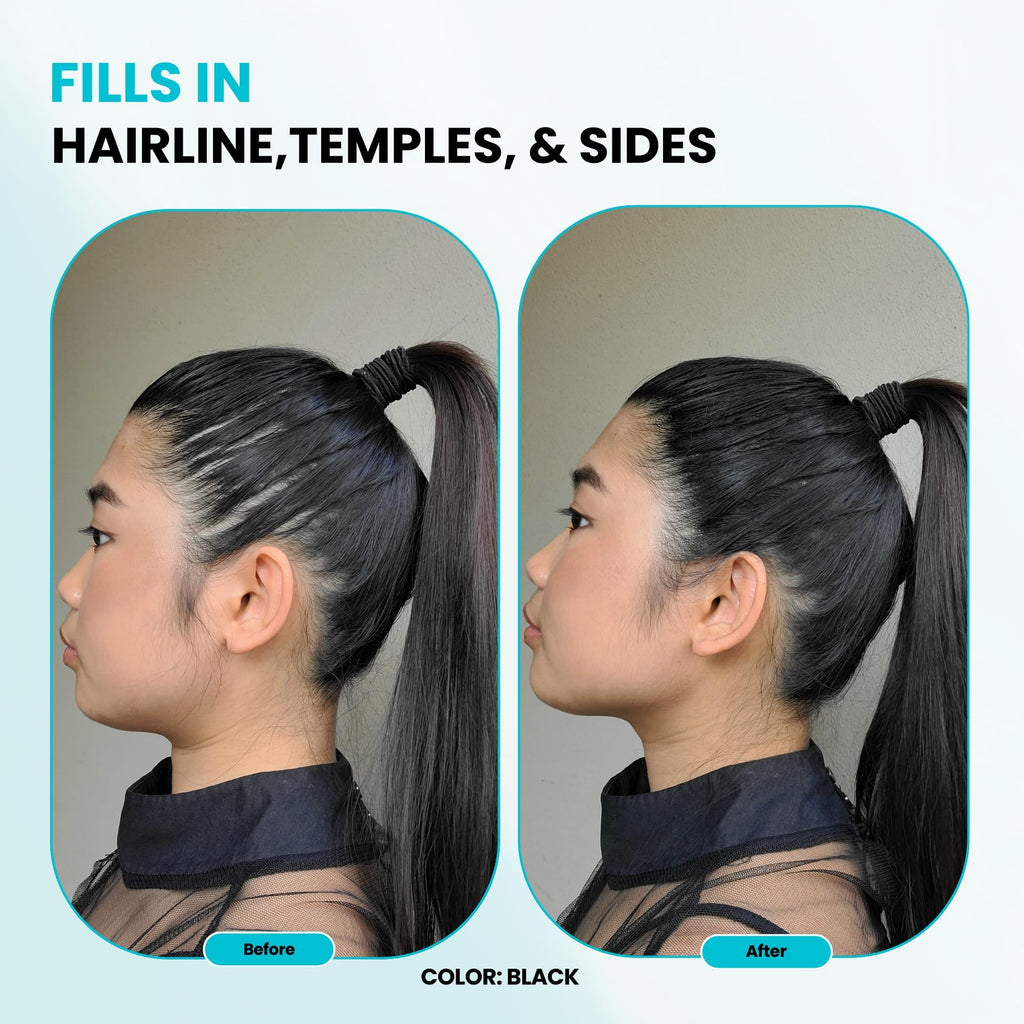SURETHIK Light Blonde Hair Fibers – Instantly Fuller Look for Thinning Hair (30g)