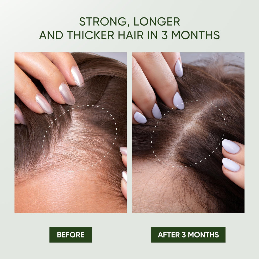 Svvimer Rosemary Hair Growth Shampoo – Thickening & Regrowth Formula with Biotin & Tea Tree Oil (11.8 fl oz)