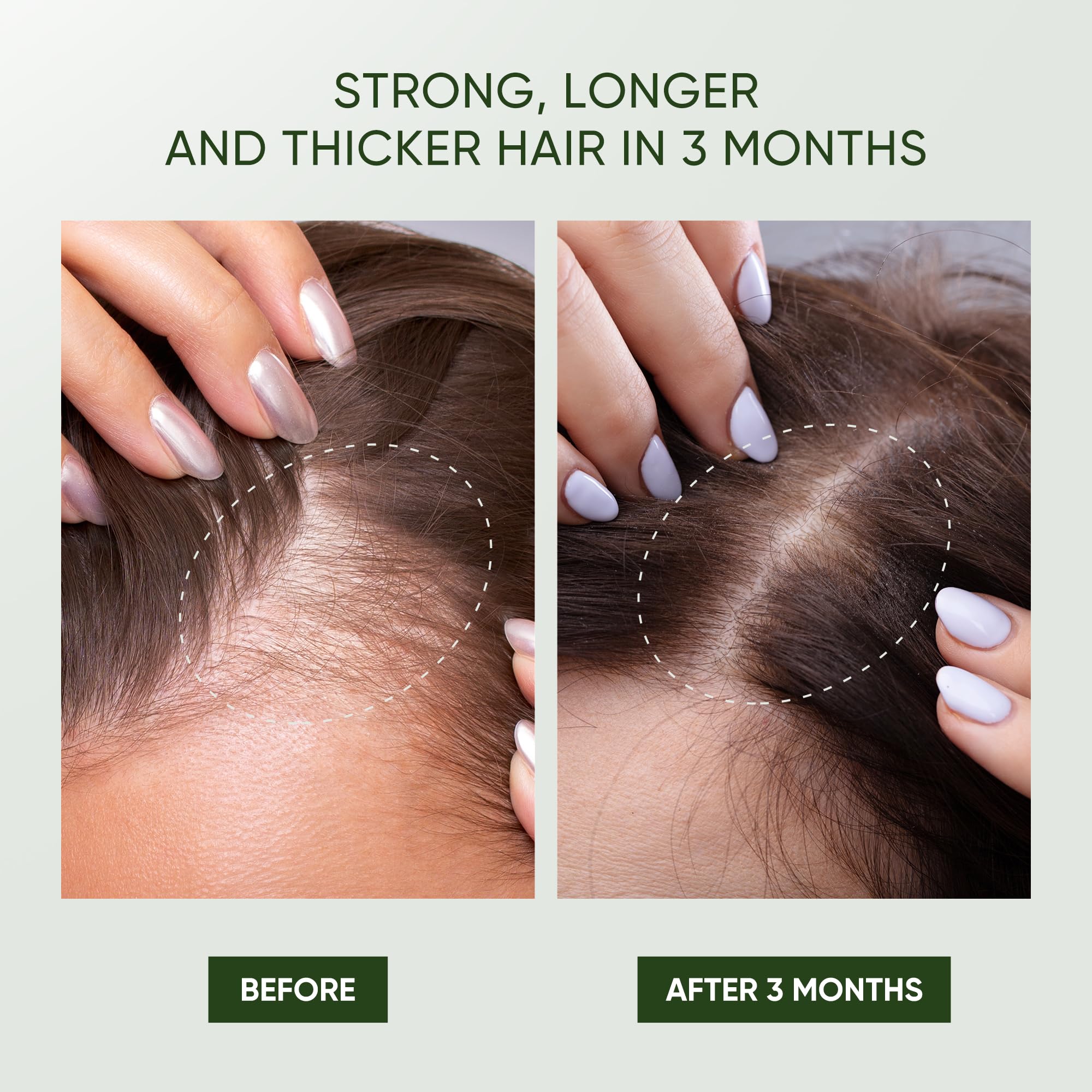 Svvimer Rosemary Hair Growth Shampoo – Thickening & Regrowth Formula with Biotin & Tea Tree Oil (11.8 fl oz)