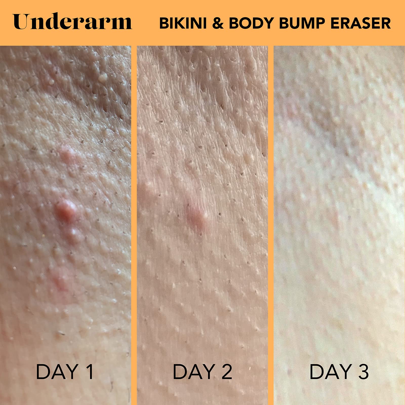 SweetSpot Labs Bikini & Body Bump Eraser – Pack of 2 x 0.5oz | Niacinamide & Bentonite Clay