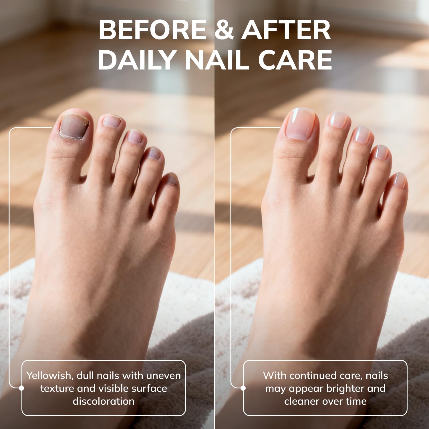 Swissklip KlearNail Toenail Stick | Medi-Care for Healthy Nails | Made in USA
