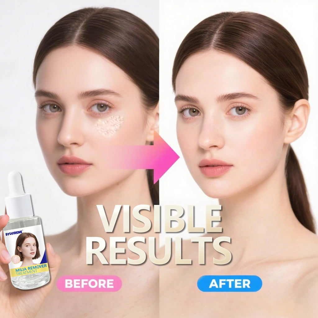 Sylvirene Milia Remover Treatment Serum 40ml – Eye & Face Milia Solution