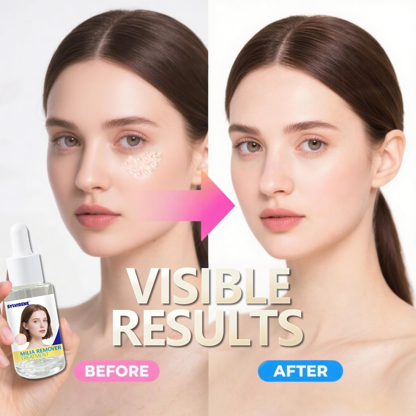 Sylvirene Milia Remover Treatment Serum 40ml – Eye & Face Milia Solution