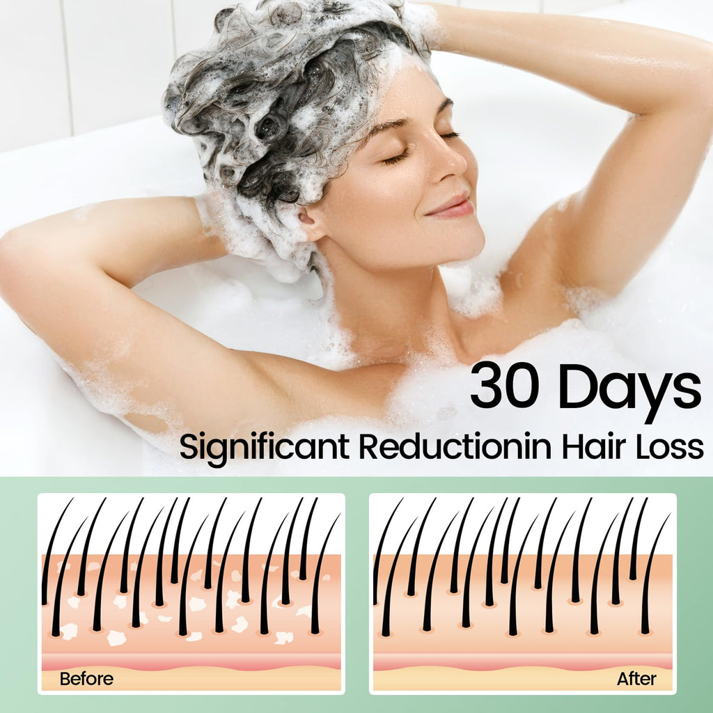 Sysni Rosemary Tea Tree Keratin Shampoo – Hydrating Cleansing for Men & Women