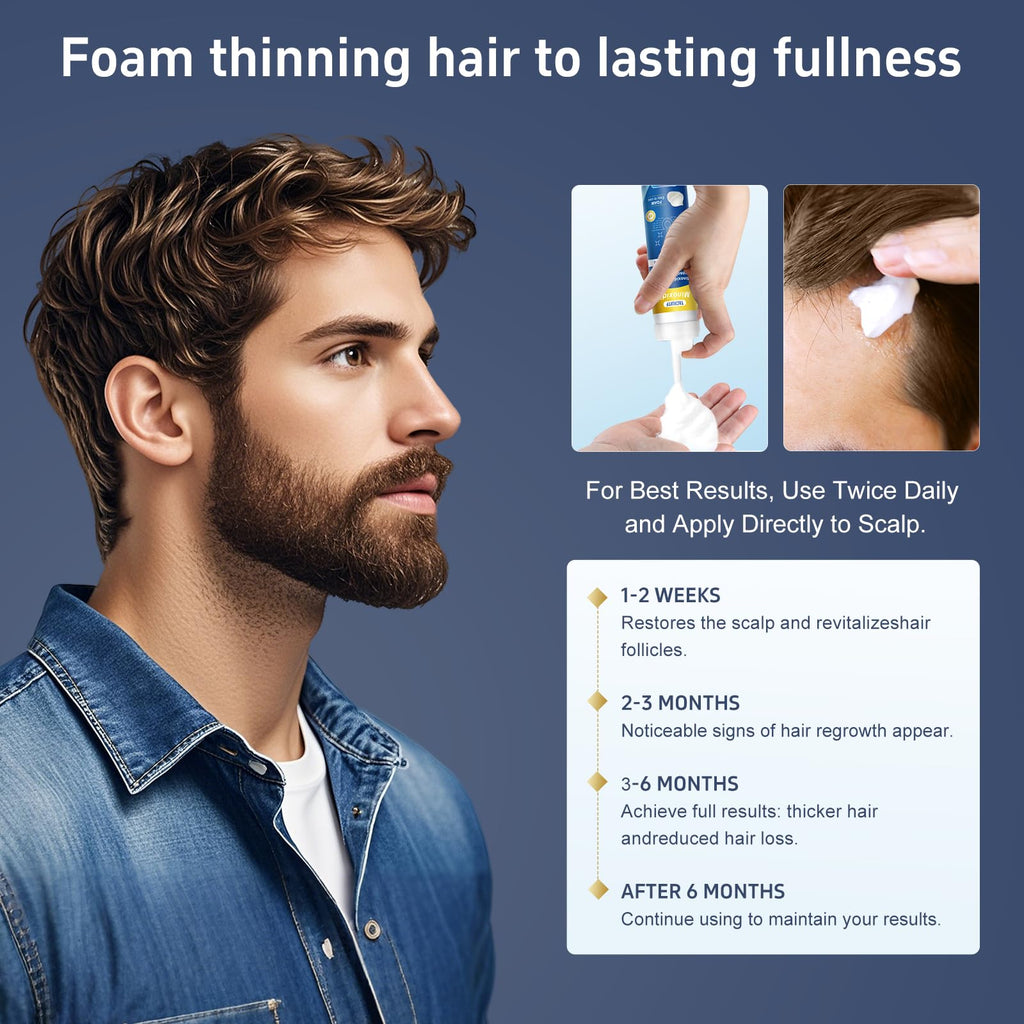 Tacruitf 4-Pack Minoxidil Foam 5% – Hair & Beard Growth, Biotin-Infused, 8.44 oz