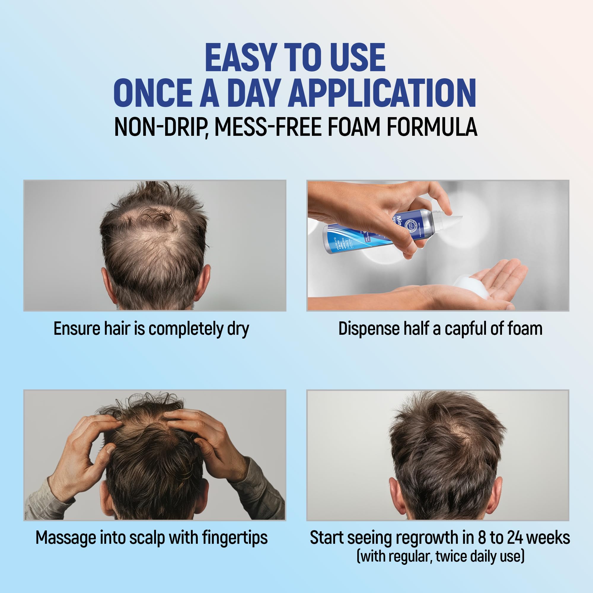 TARO Minoxidil 5% Topical Foam for Men – 2 Month, 2-Pack, 2.11 oz