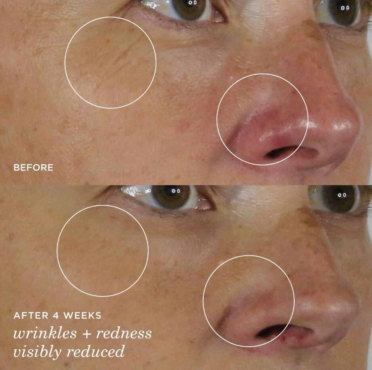 Tatcha Silk Serum | Wrinkle-Smoothing Retinol Alternative 30 ml
