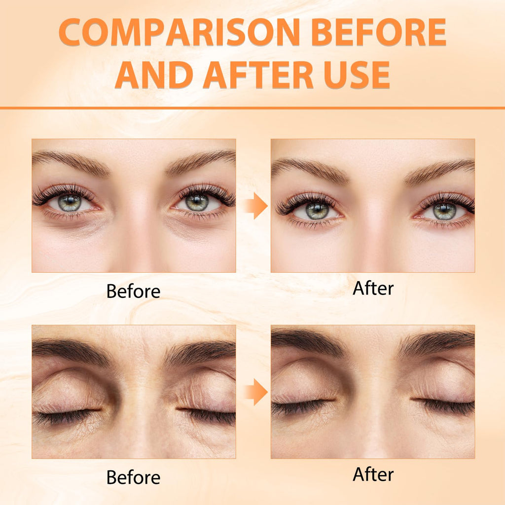 Tbexem Revive Glow Vitamin C Eye Balm – Hydrating Eye Cream (2PCS)