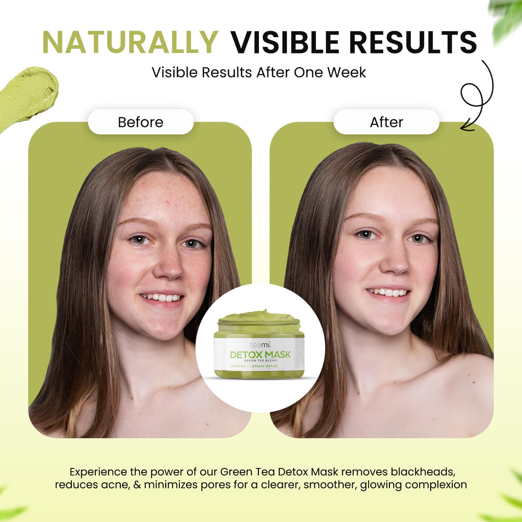 Teami Detox Face Mask: Hydrating, Purifying & Pore-Minimizing Green Tea Mask for All Skin Types