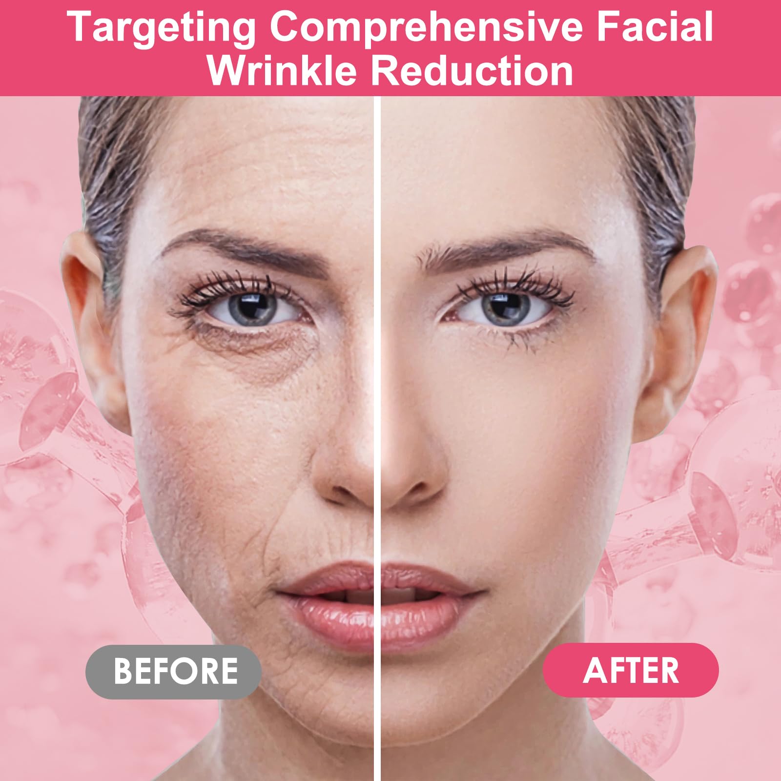 TEAWOO 16 PCS Reusable Face Wrinkle Patches Kit – Overnight Patches for Forehead and Eye Areas