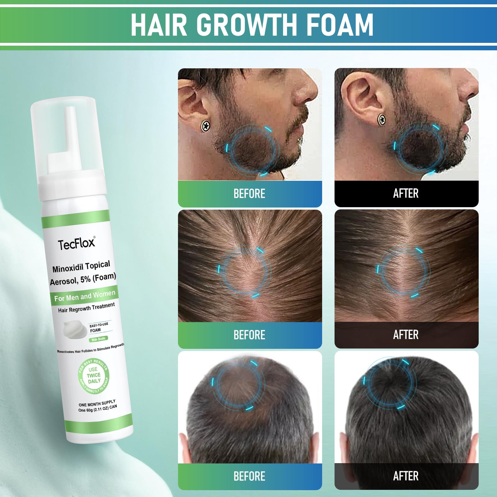 TECFLOX Minoxidil Foam 5% with Biotin for Hair & Beard Growth – Unscented, 3-Month Supply