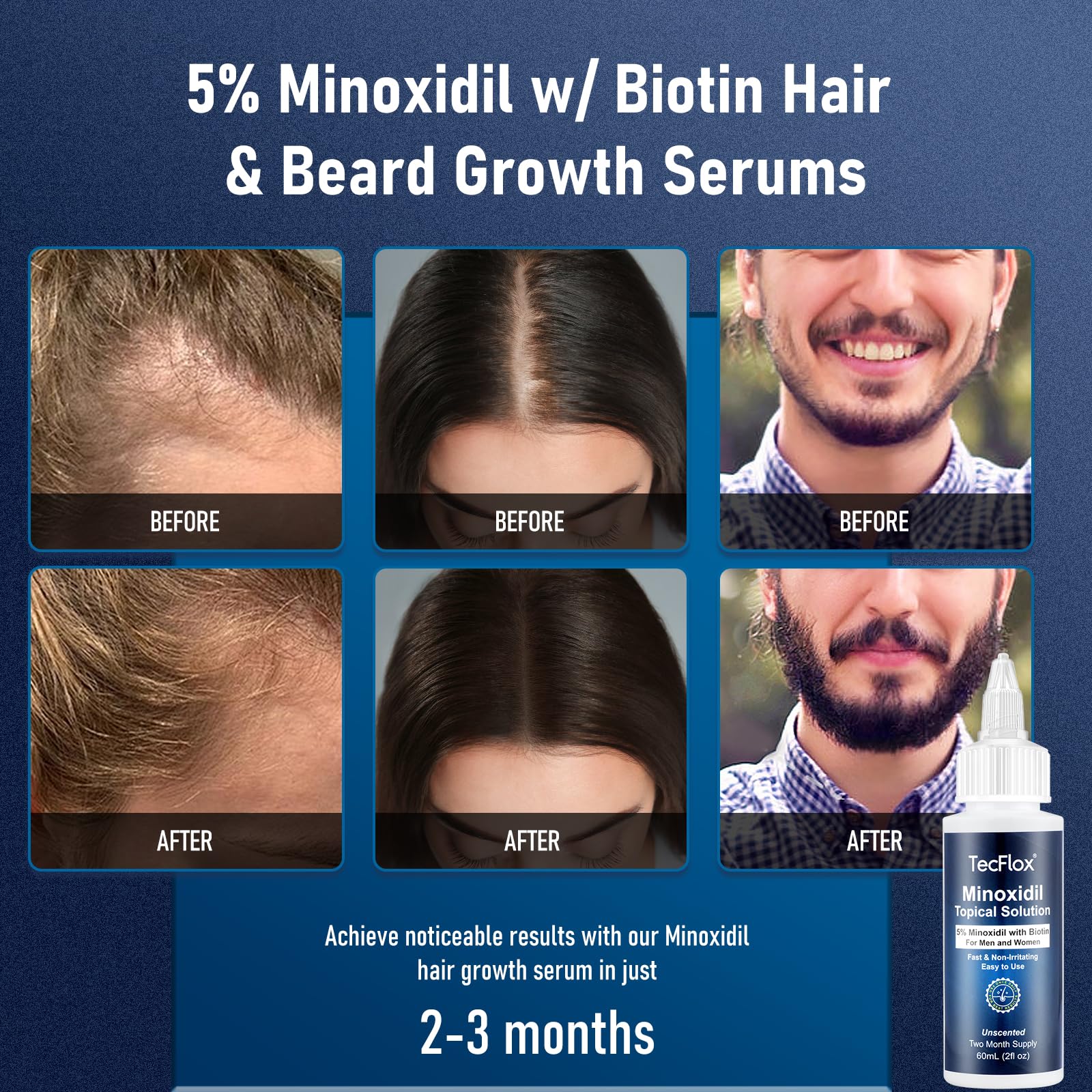 TECFLOX 5% Minoxidil with Biotin – Hair Growth Serum for Men & Women | 4 fl oz (2x60 ml) Unisex