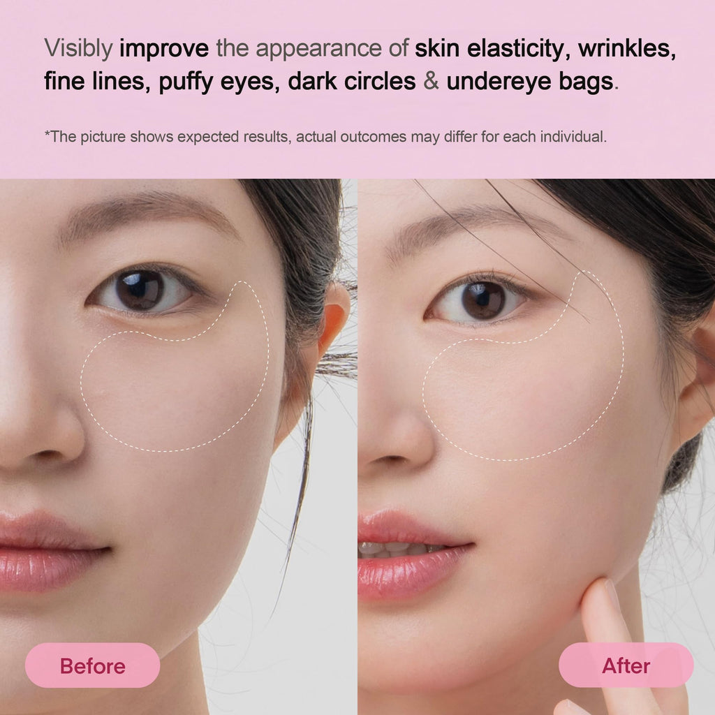 TEREZ & HONOR Peptide Collagen Hydrogel Eye Patches – 24 Pairs – Hydrating, Firming Under-Eye Pads