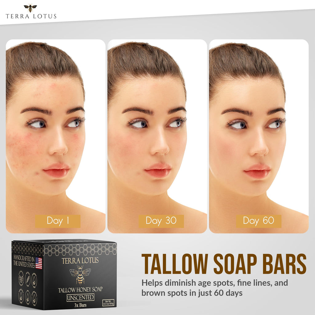 Terra Lotus Organic Tallow Soap with Honey & Castor Oil – 3 Pack Citrus