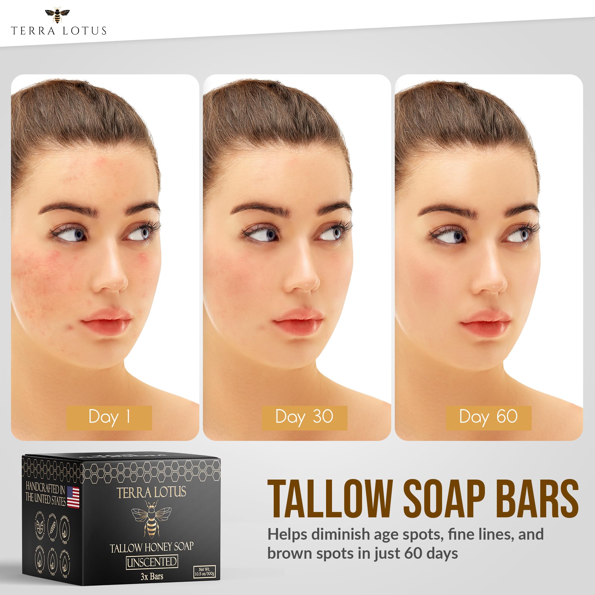 Terra Lotus Organic Tallow Soap with Honey & Castor Oil – 3 Pack Citrus