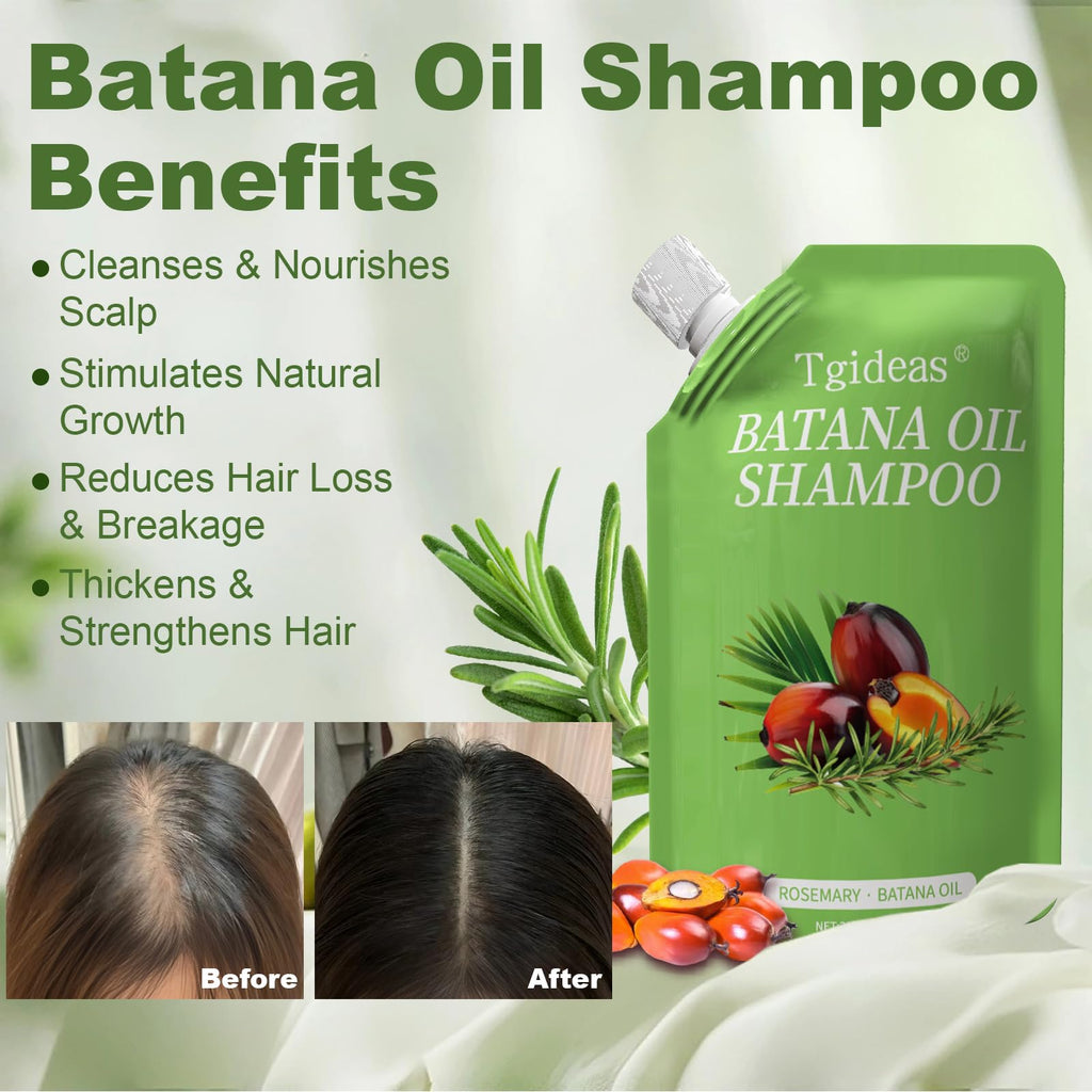 Tgideas Batana Oil & Rosemary Shampoo – Hair Growth Support, Sulfate-Free, Pack of 2