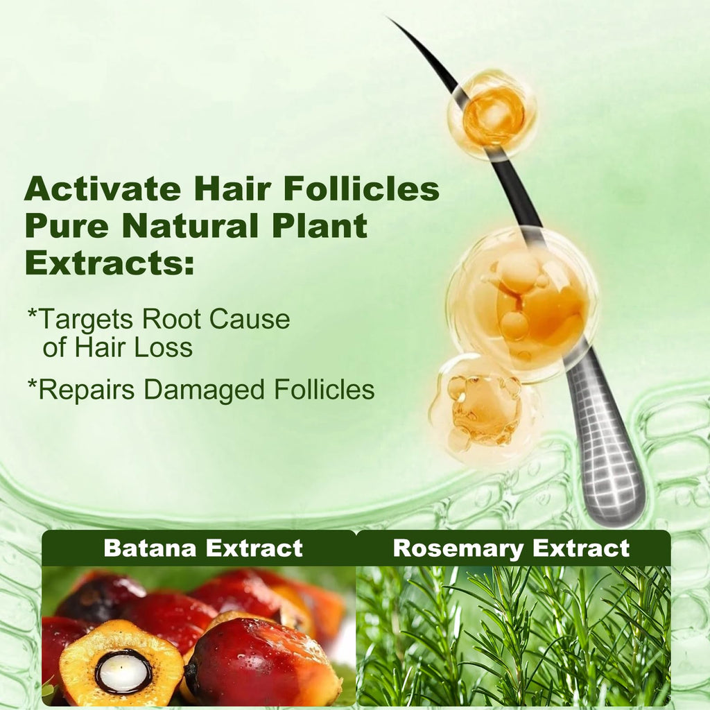 Tgideas Batana Oil & Rosemary Shampoo – Hair Growth Support, Sulfate-Free, Pack of 2