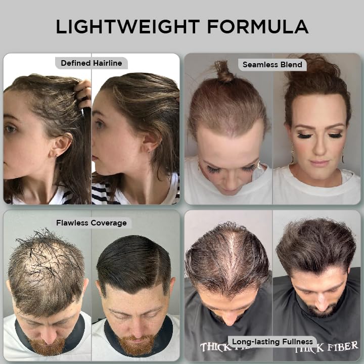 THICK FIBER Hair Fibers for Thinning Hair & Bald Spots (Dark Brown, Pack of 3) – 25g Bottle