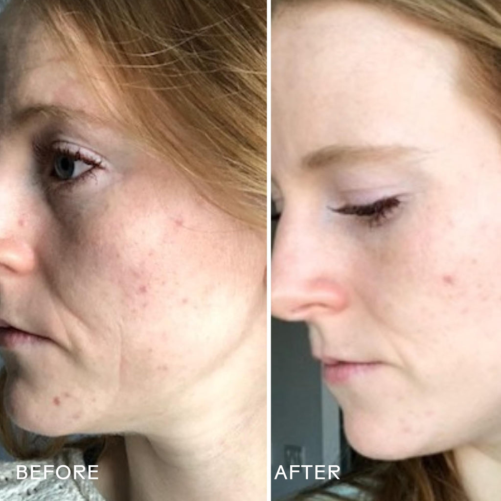 Three Ships Refresh Papaya + Salicylic Acid Cleanser | Oily/Acne-Prone Skin