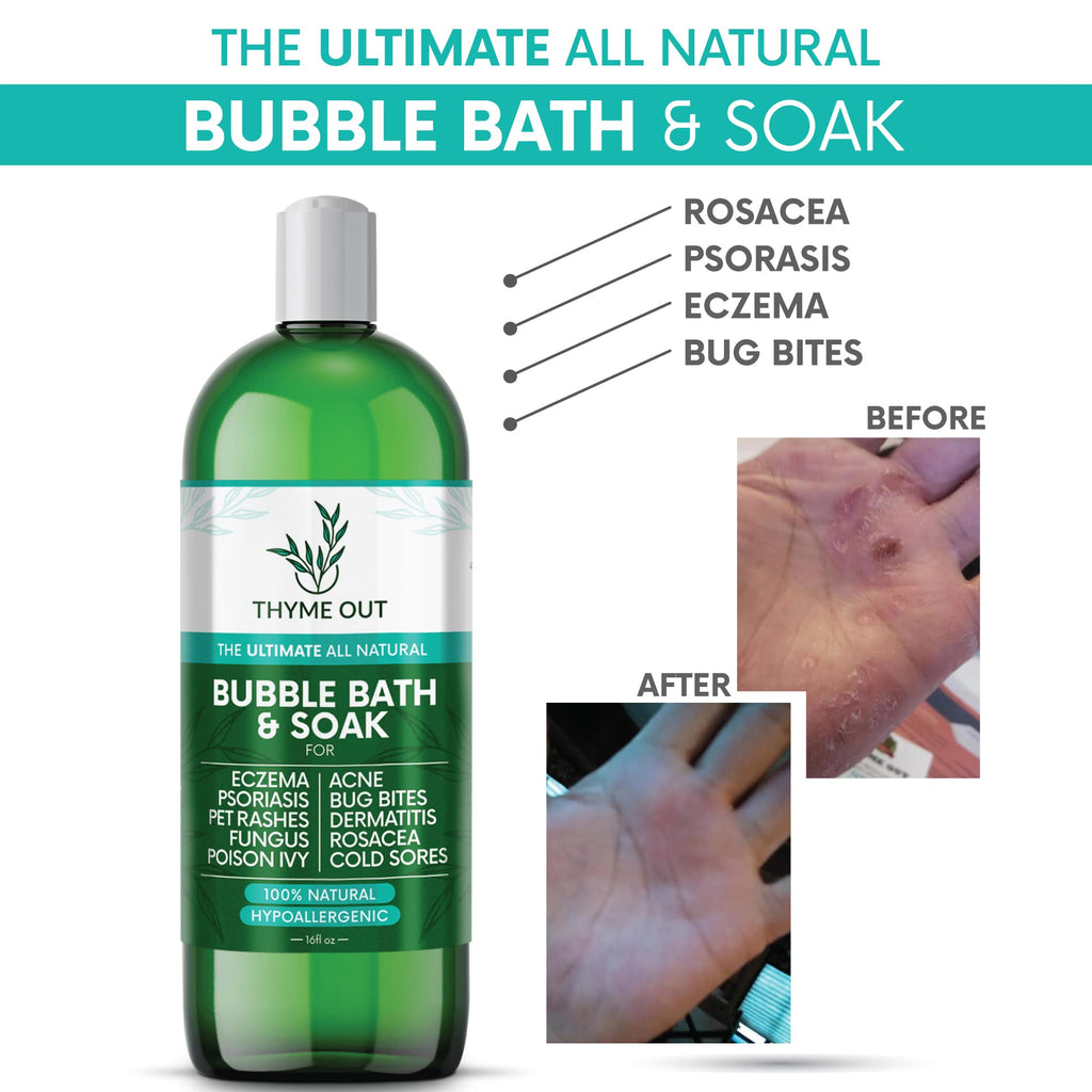Thyme Out All Natural Bubble Bath – Plant-Based, Hypoallergenic Bath Soak (16oz)