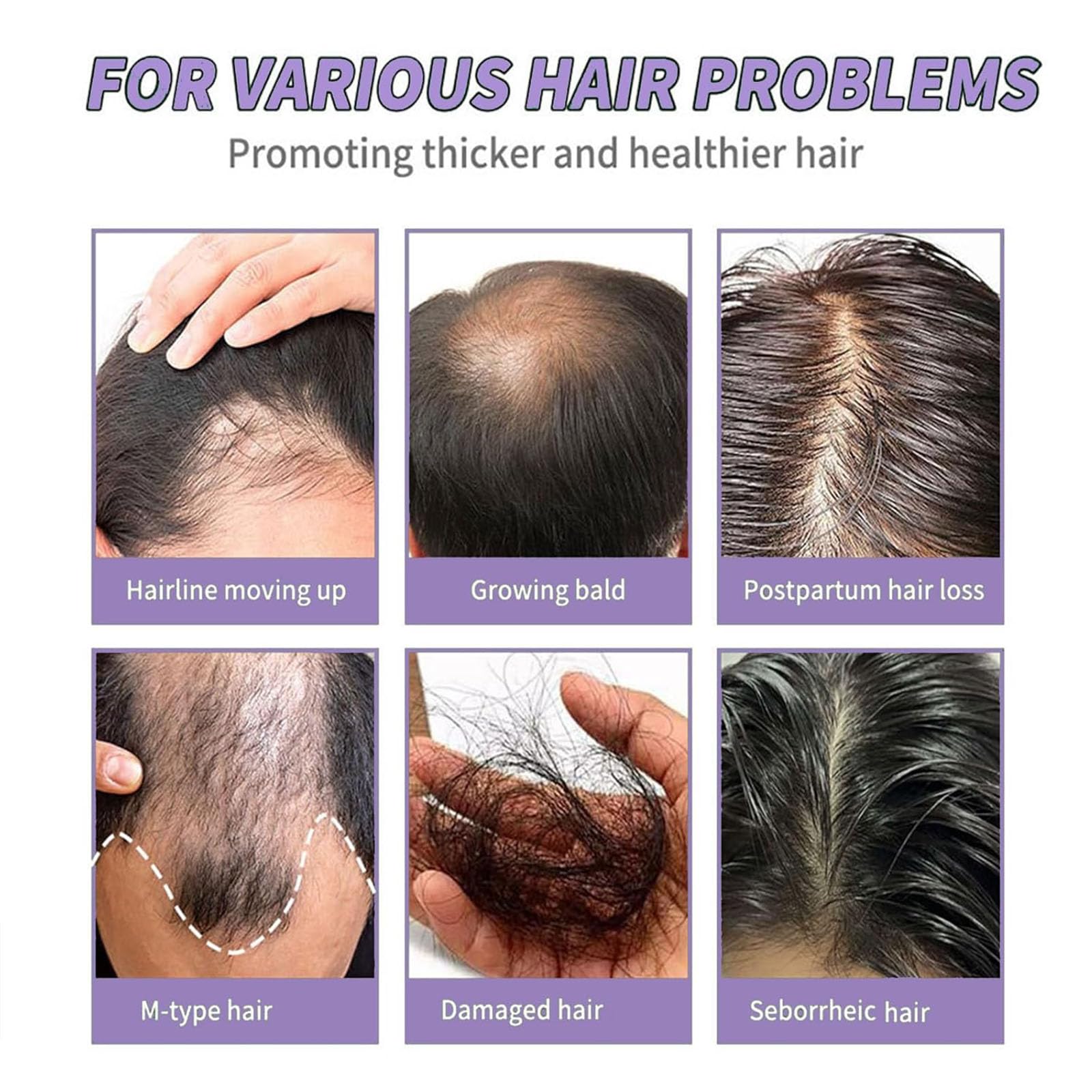 Tiliraiy Batana Oil – Organic Honduran Hair Growth Oil Paste, 100% Pure Batana Oil for Thicker, Shiny Hair