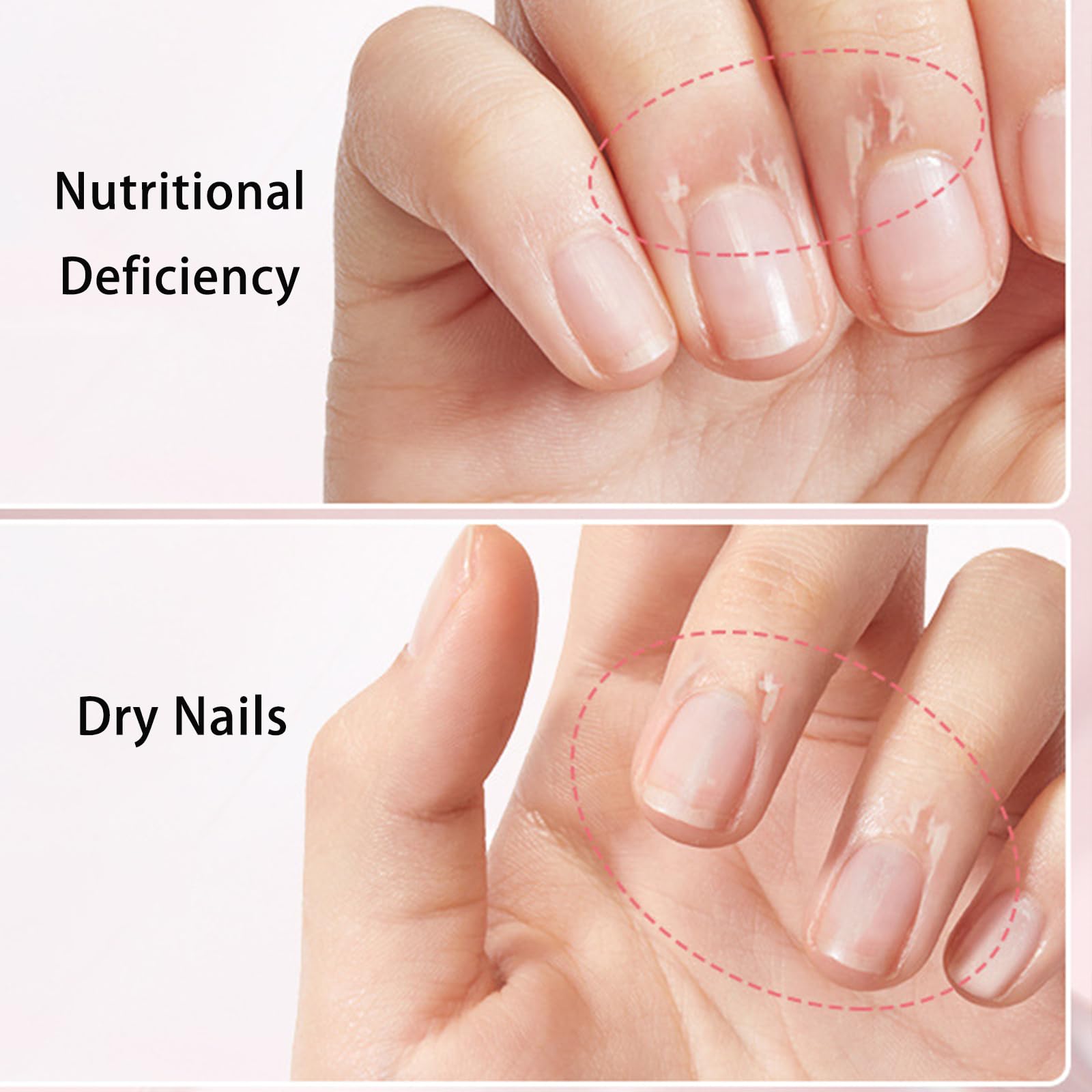 Tiliraiy Nail Growth Pen – Radiant Nail Care with Lemon Tea Tree Cuticle Oil