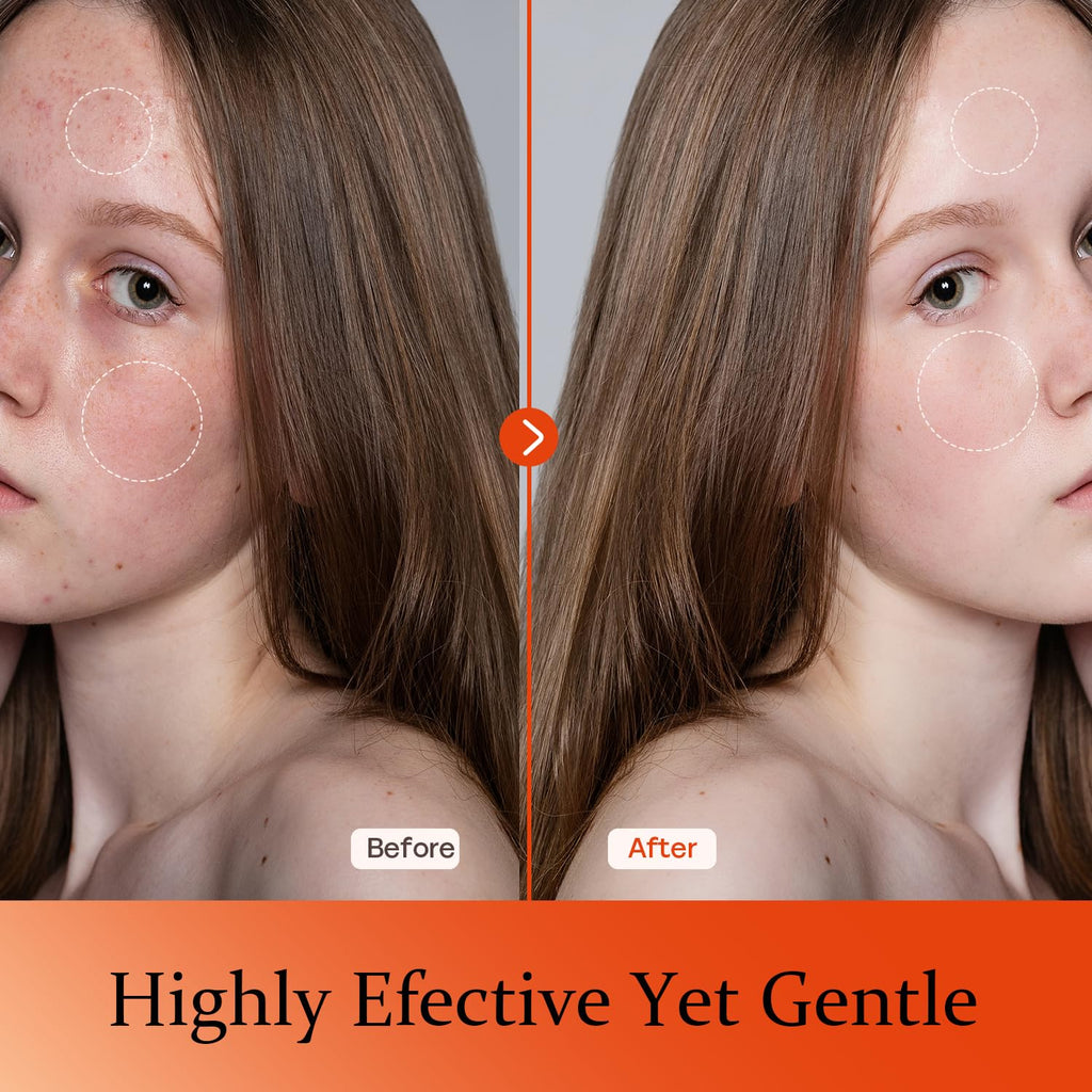 Tinclen Vitamin C Serum for Face – Brightening, Hydration & Anti-Aging
