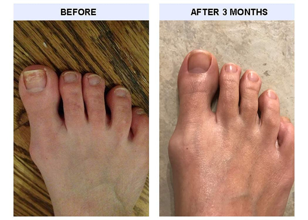 TIPS Toe Nail Conditioner 2 Pack | Strengthen & Nourish Natural Toenails