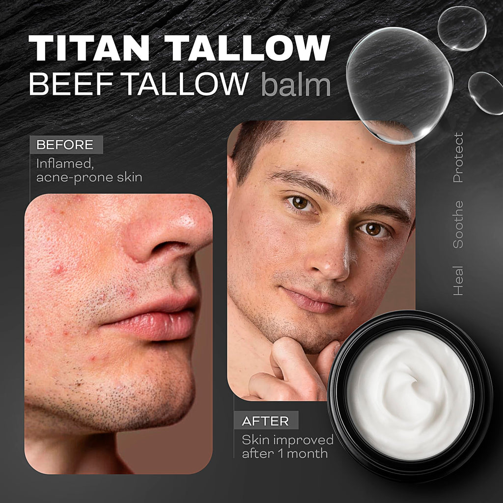 Titan Tallow Beef Tallow Balm with Magnesium – Sleep Support, Muscle Relief & Deep Hydration
