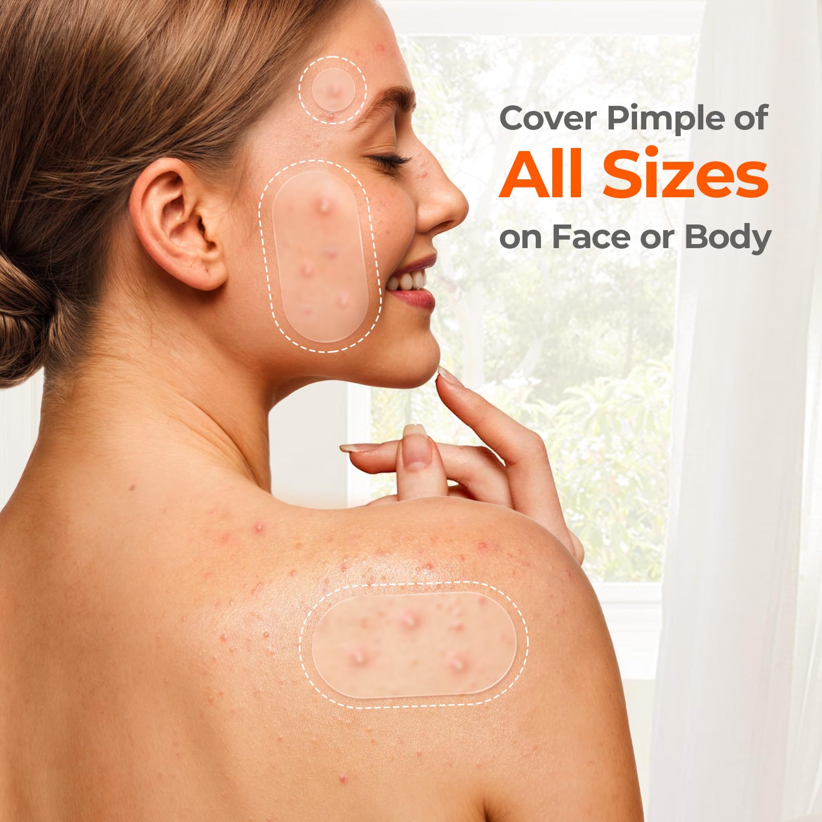 TKTK 609-Count Pimple Patches for Face | Hydrocolloid Acne Patches Bulk