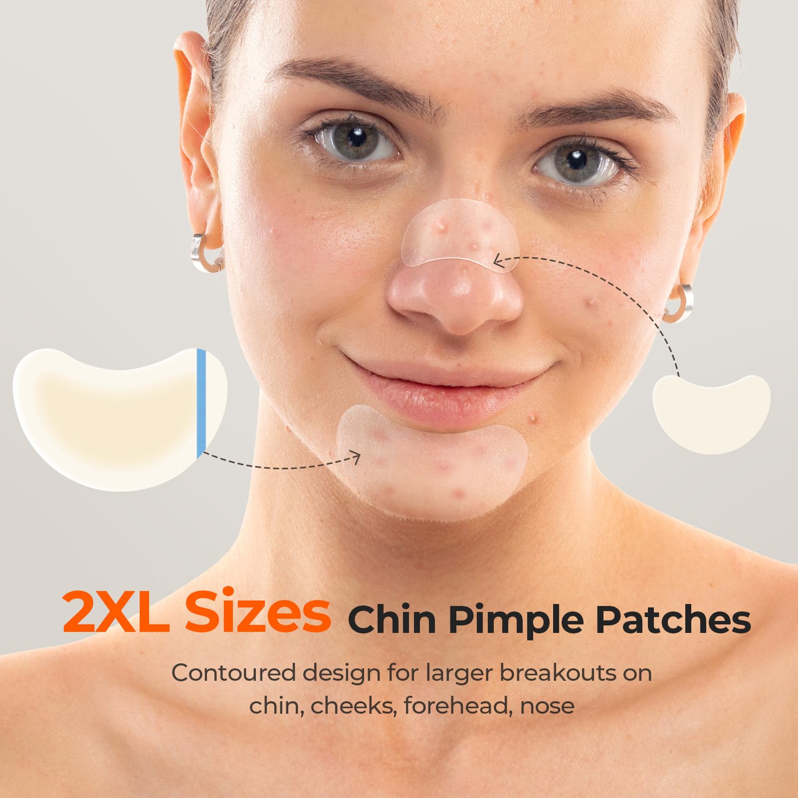 TKTK Chin Pimple Patches — 265 Count, 6 Sizes, XL Contoured 62x42 mm and L 38x26 mm
