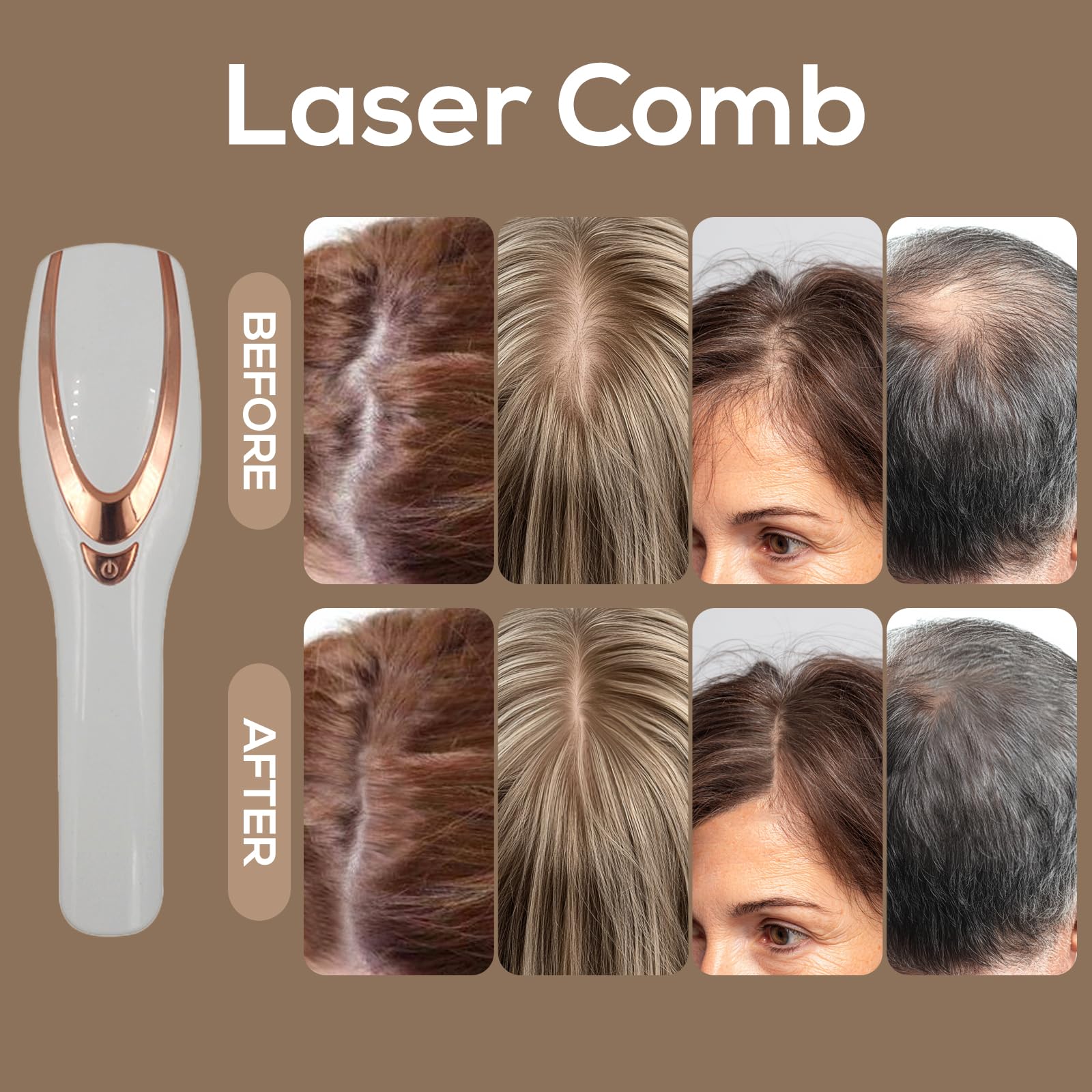 TMOSSO Laser Therapy Hair Growth Comb – Handheld Low-Level Laser Therapy Device for Scalp