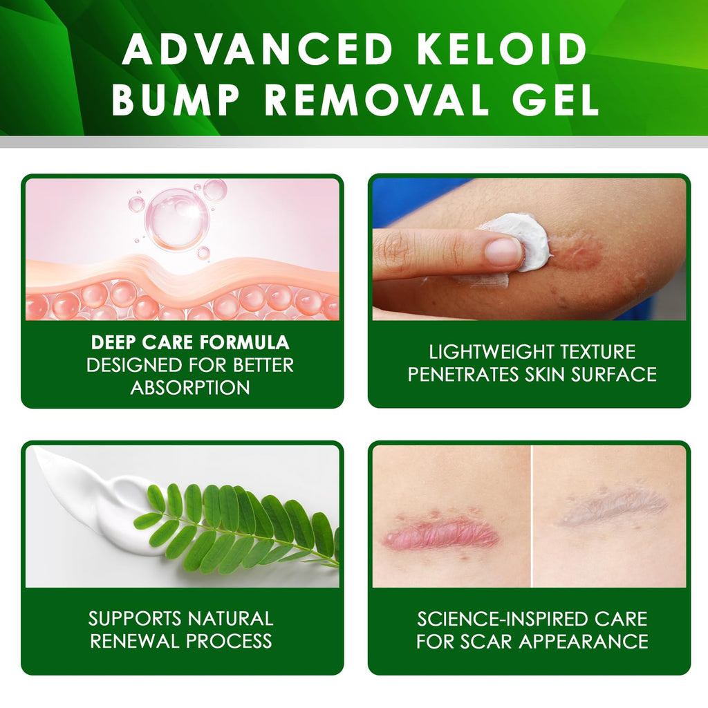 Tobcharm Advanced Keloid Scar Gel – Silicone Scar Care, 2-Pack (30g x2)