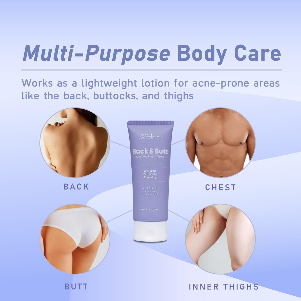 Tobcharm Butt Acne Clearing Treatment – Maximum Strength Body Cream for Back, Butt, Thigh & Chest
