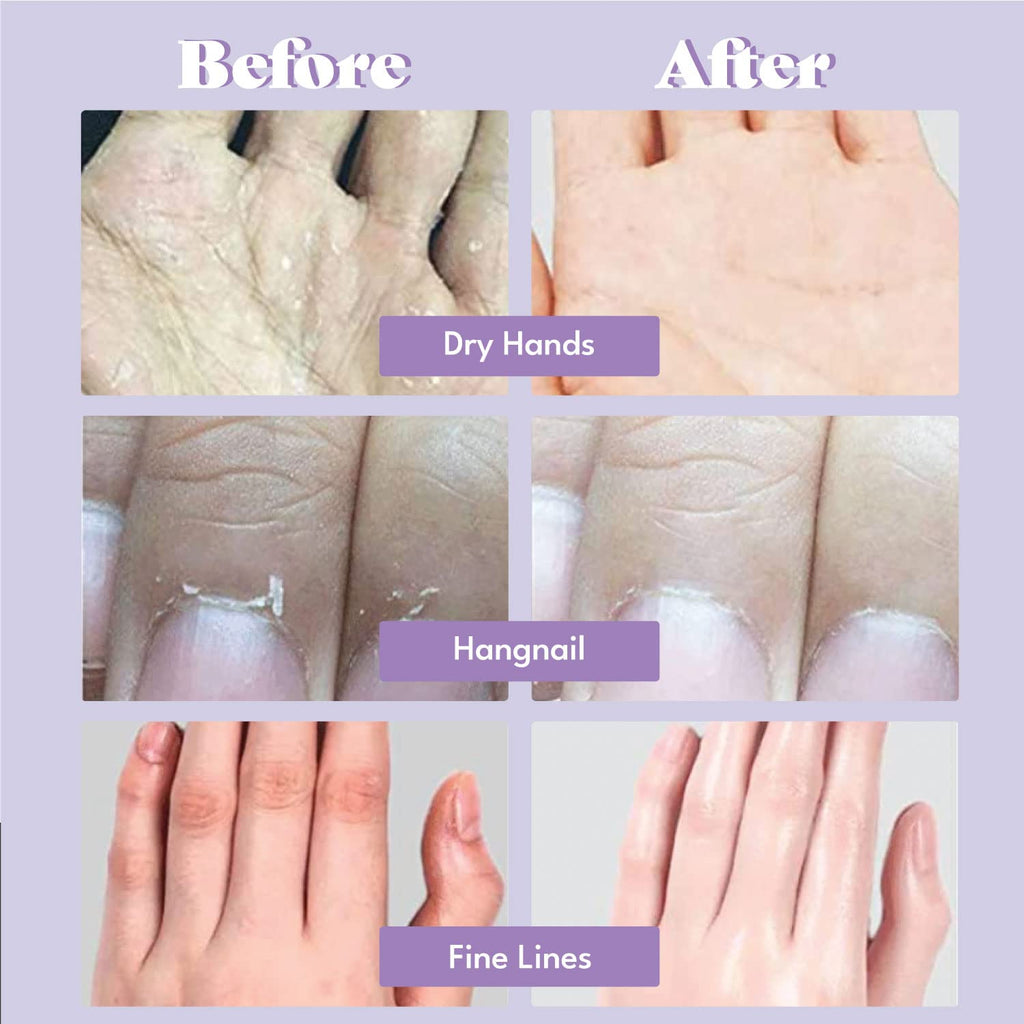 TOI:L Catherine Muller Floral Hand Mask – 8 Pairs Moisturizing Gloves with Elder Flower & CICA