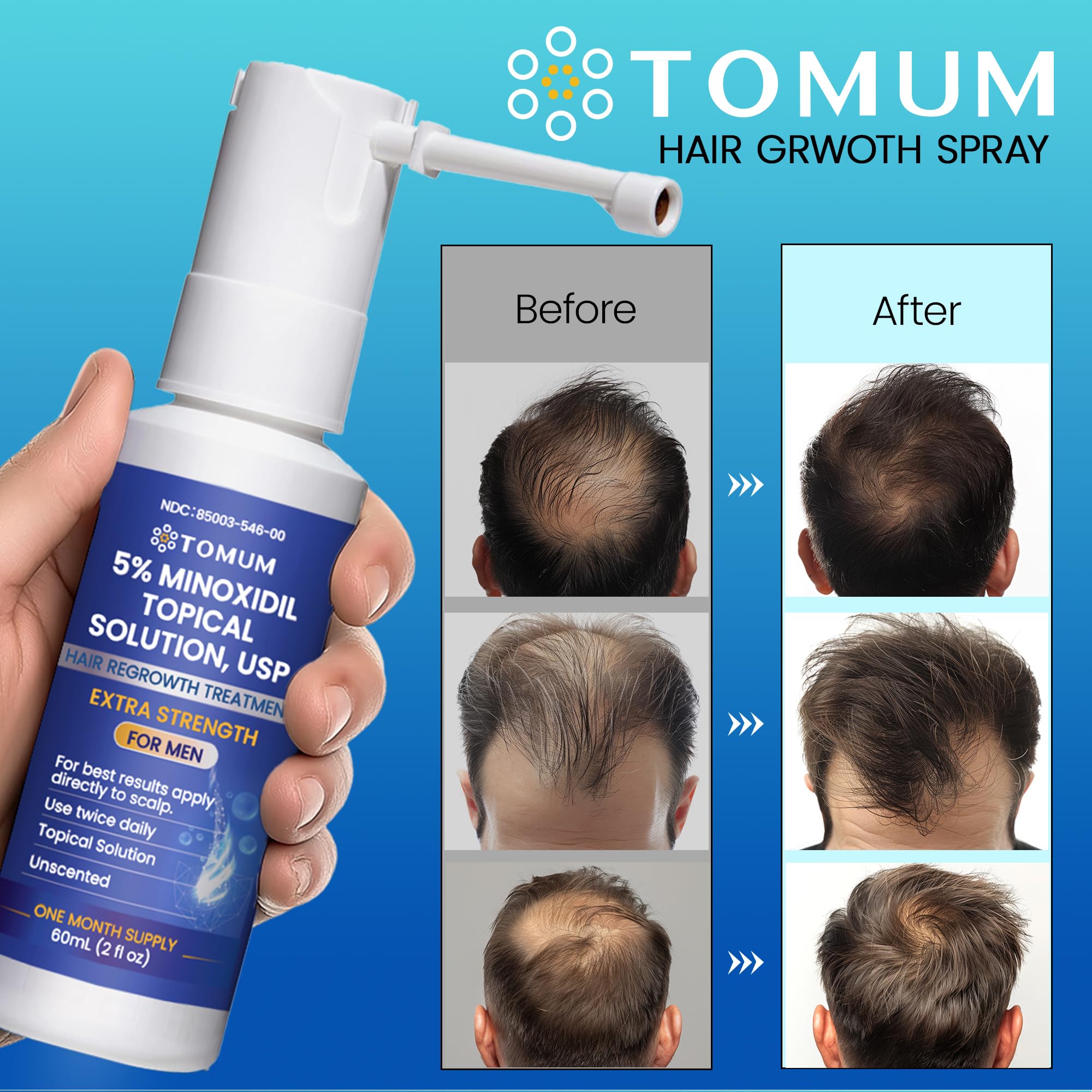 Tomum Men's 5% Minoxidil Hair Growth Spray – Extra Strength, 60ml, Made in USA