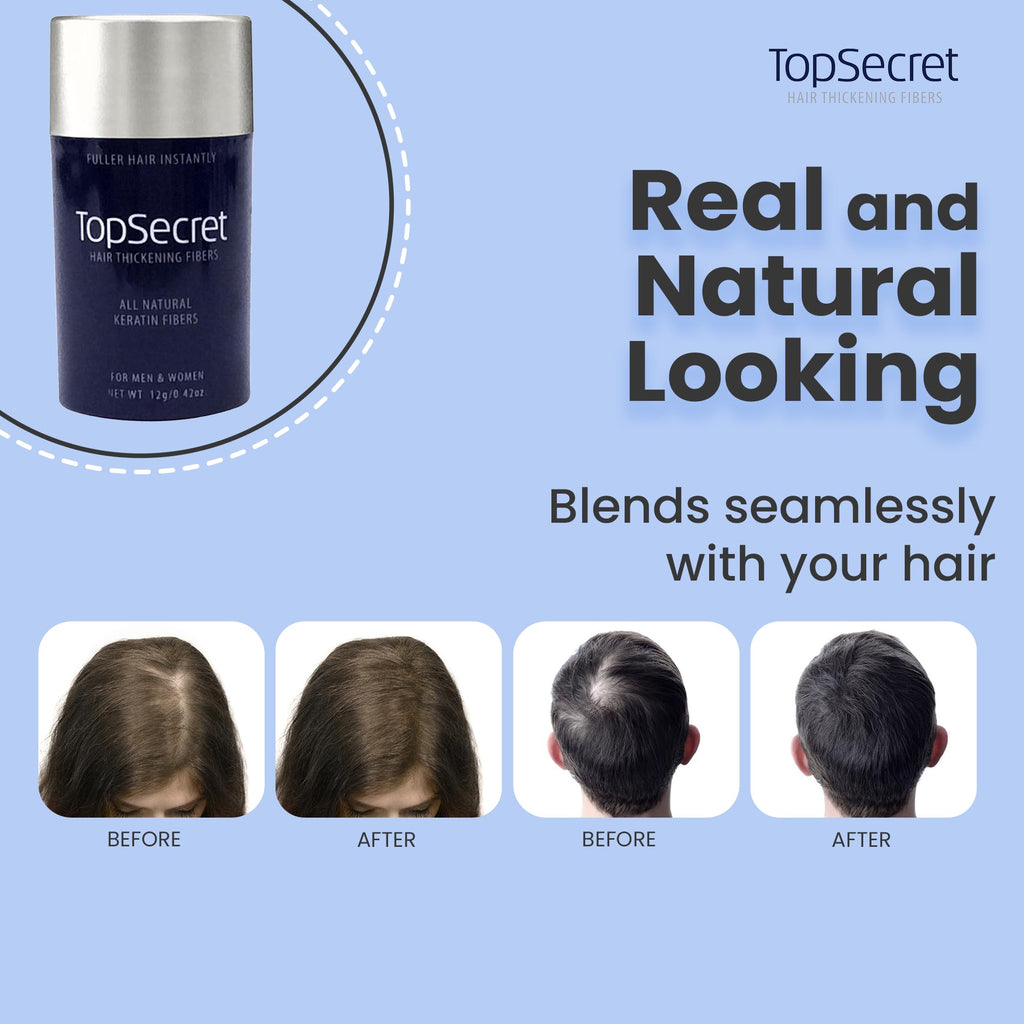Top Secret Hair Building Fiber Refills – Undetectable Thickening for Men & Women (Medium Brown)