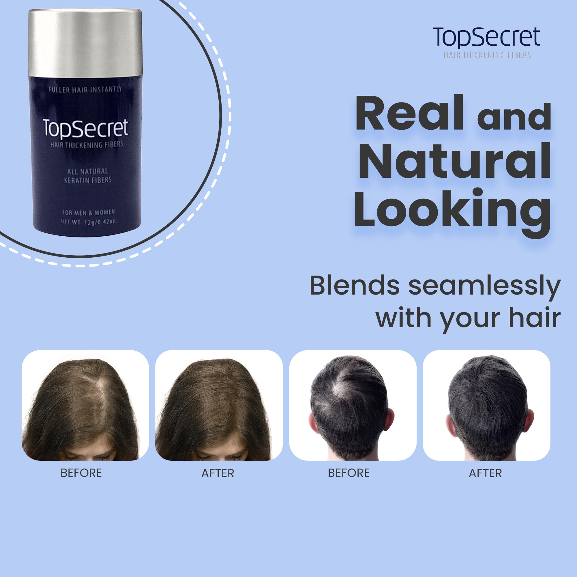 Top Secret Hair Building Fiber Refills – Undetectable Thickening for Men & Women (Medium Brown)