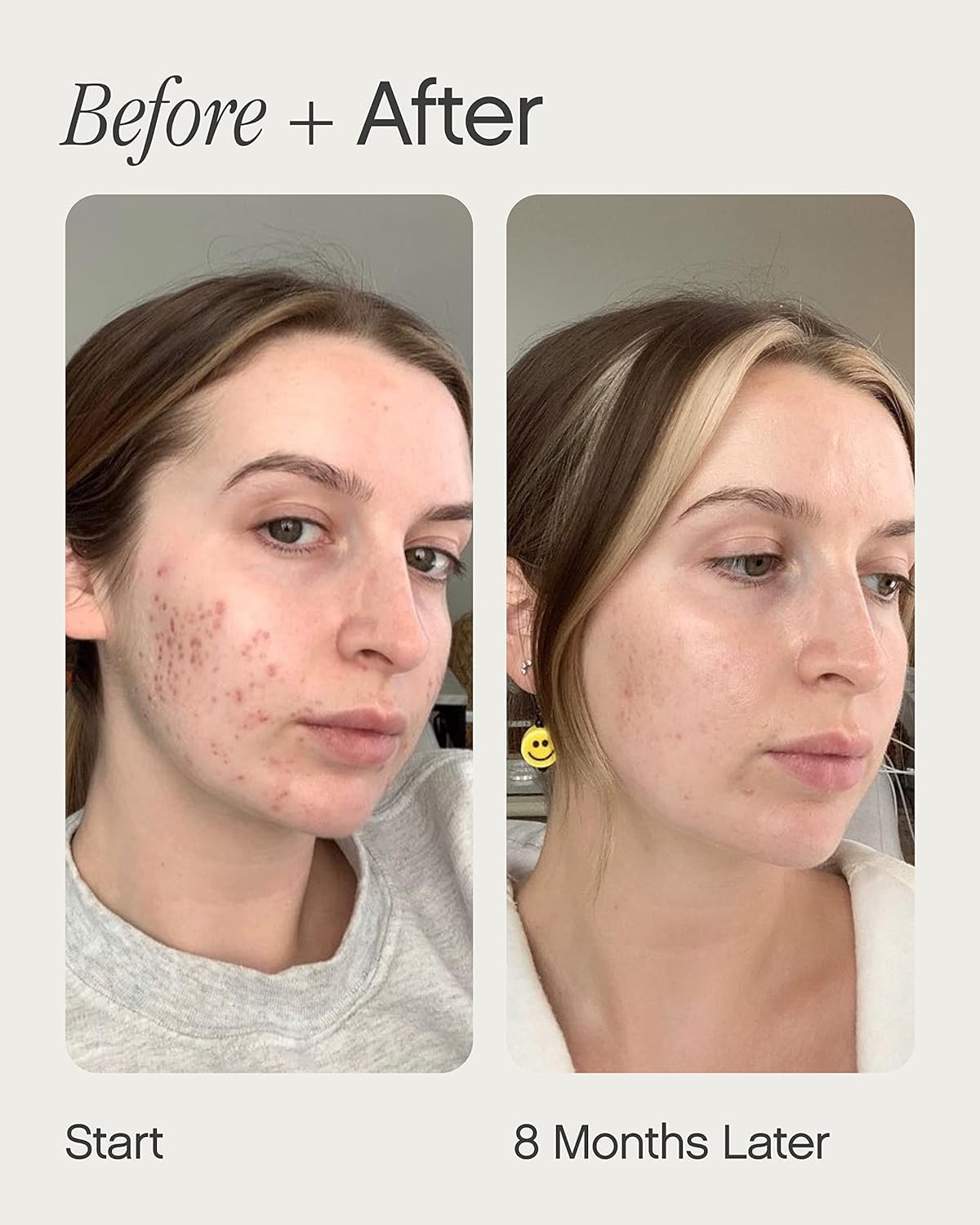 Topicals Faded Brightening and Clearing Serum | Kojic Acid + Niacinamide | Vegan & Cruelty-Free (0.5 fl oz)