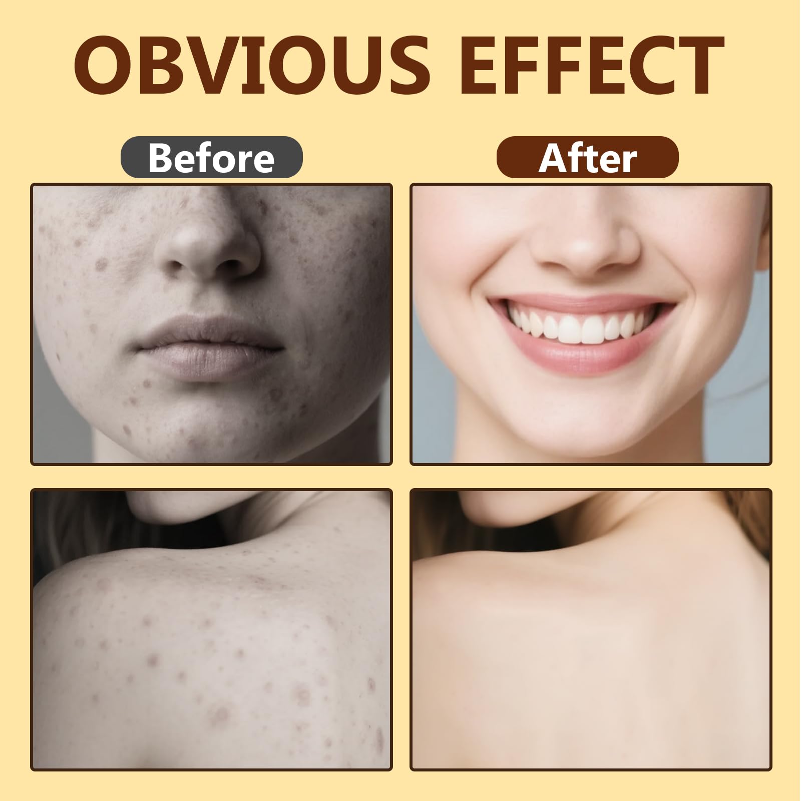 Topicy Bee Venom Cream – Natural Skin Renewal for Blemish Reduction