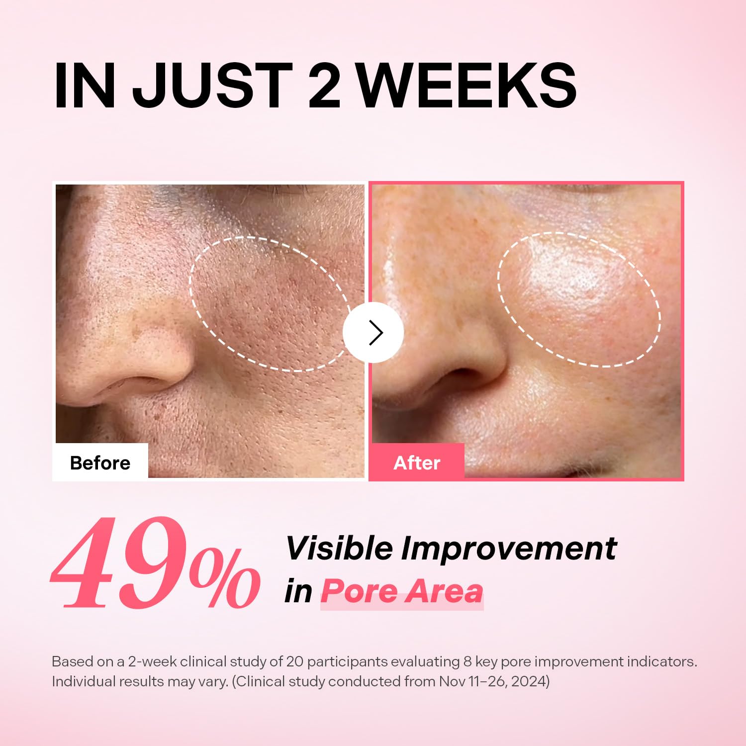 Torriden CELLMAZING Pore Perfecting Ampoule – 30ml | 5D Collagen, Peptide Complex, PHA & LHA | Korean Skincare