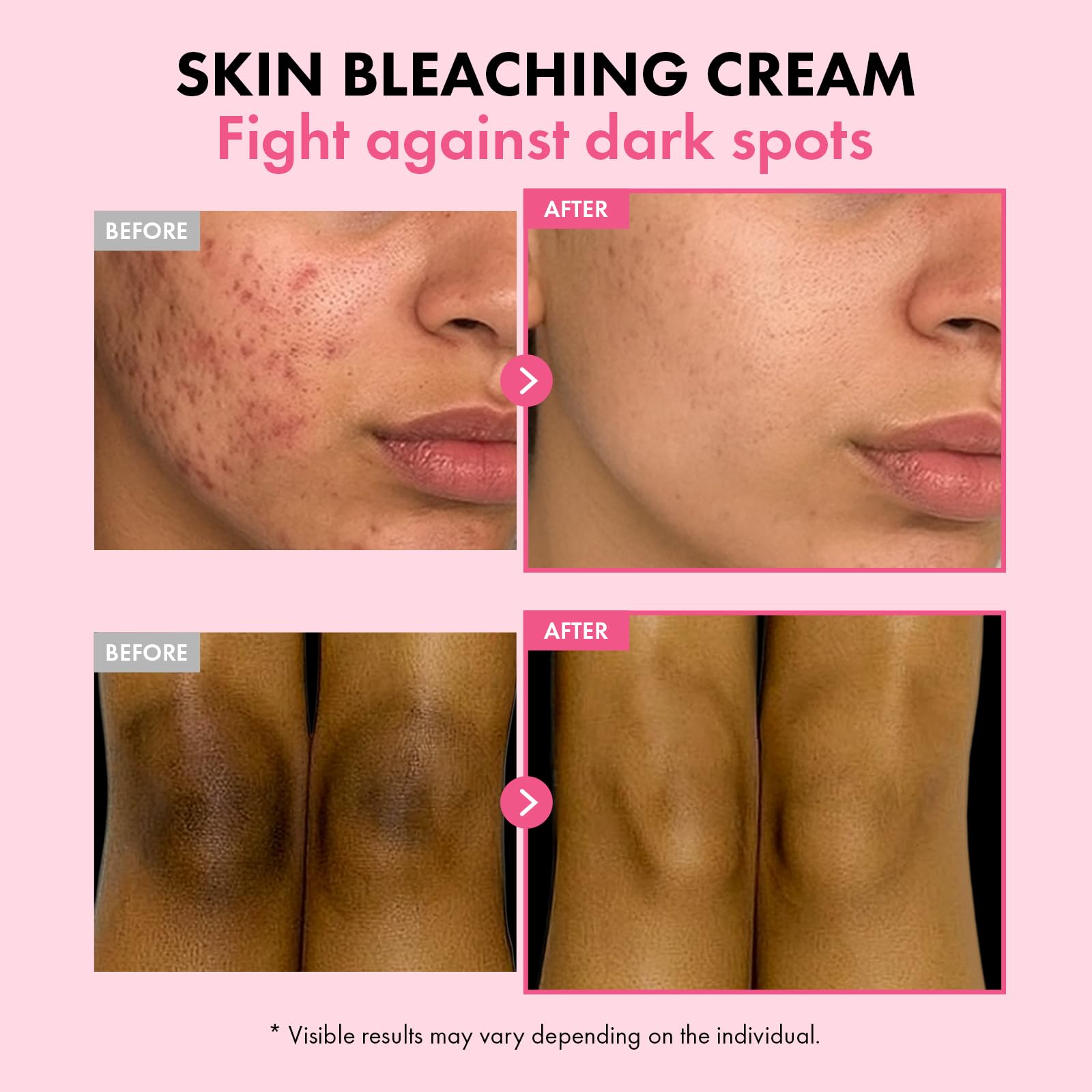 TOSOWOONG Dark Spot 35 Fade Cream | Arbutin, Kojic Acid, Niacinamide - Korean Skincare 50ml