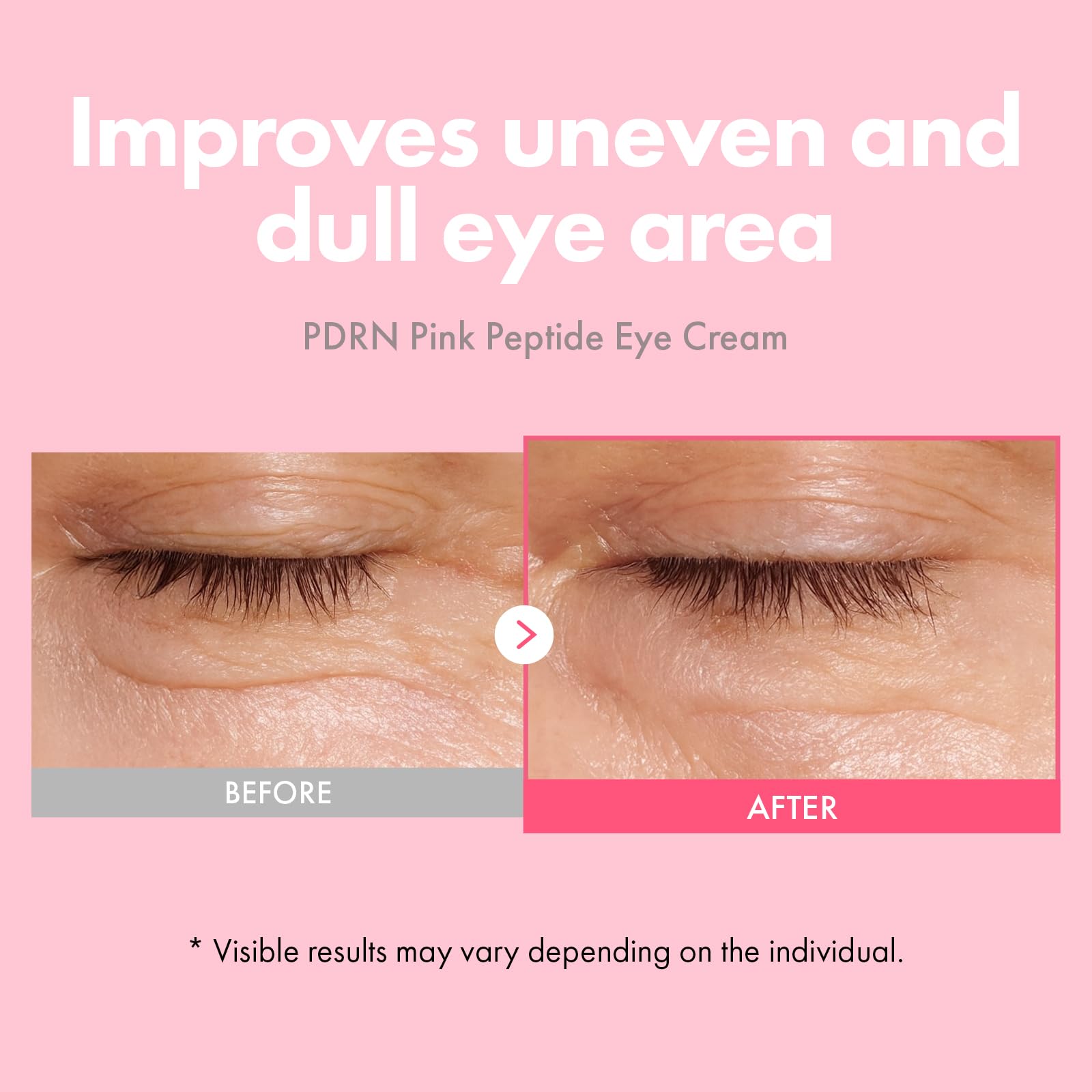TOSOWOONG PDRN Pink Peptide Eye Cream – Salmon DNA PDRN 5000ppm, Liposome Retinol, Caffeine (30ml)