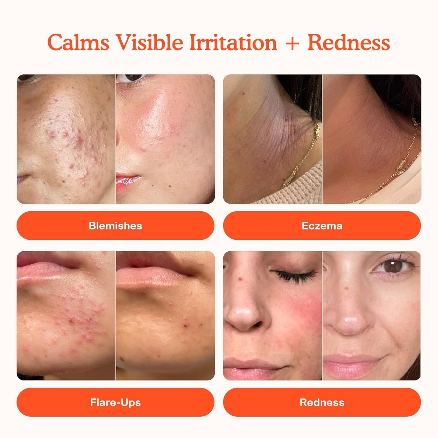Tower 28 SOS Daily Rescue Facial Spray — Calms Irritation & Redness (Full + Travel Size Duo)