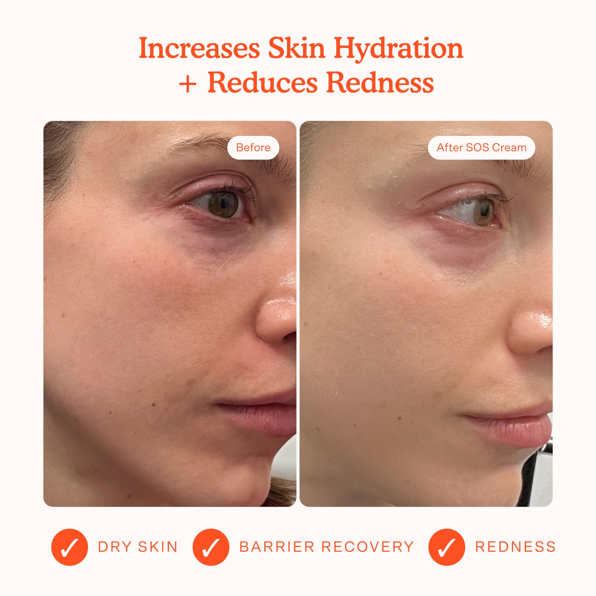 Tower 28 SOS Recovery Face Cream — Hydrating Moisturizer for Sensitive Skin with Hyaluronic Acid + Ceramides