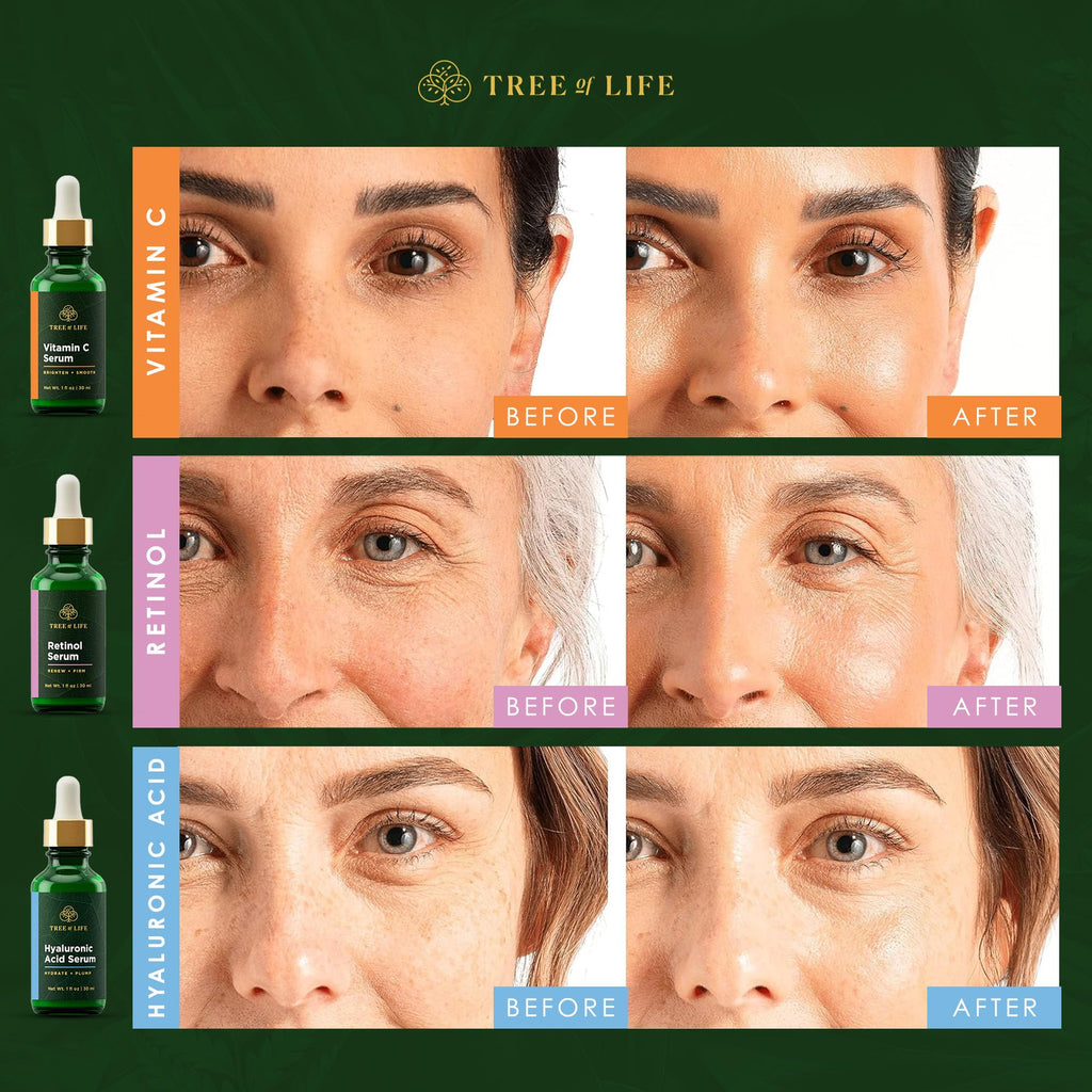 Tree of Life Beauty Facial Serum Trio — Vitamin C, Retinol & Hyaluronic Acid Kit