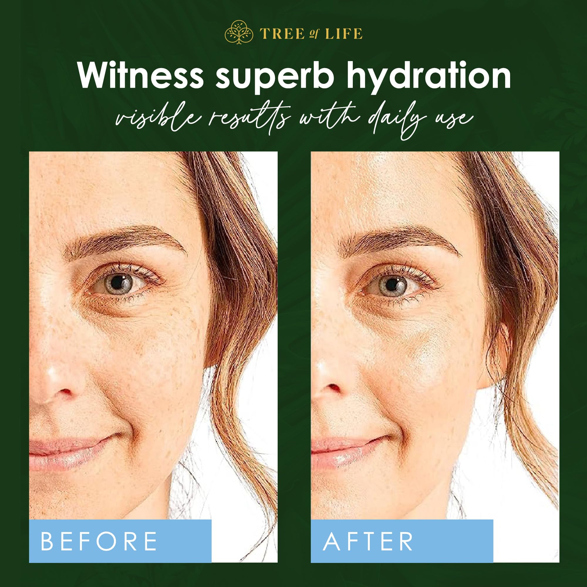 Tree of Life Beauty Hyaluronic Acid Serum – Hydration & Brightening for Dry/Sensitive Skin | 2 Fl Oz x2