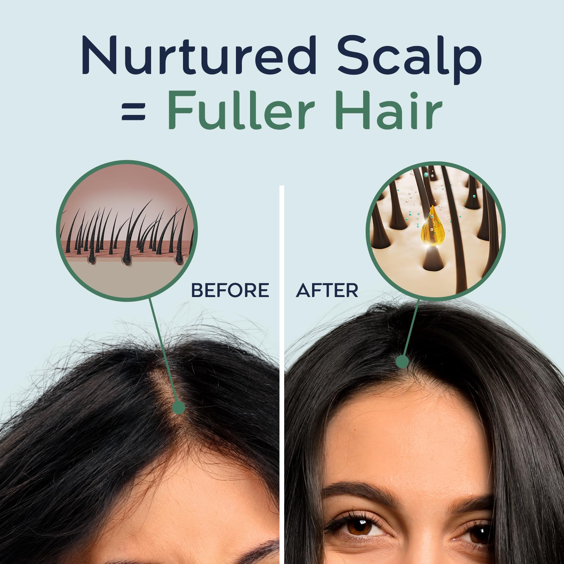Tree To Tub Rosemary Water Spray for Hair Growth – Fermented Rice Water with Rosemary