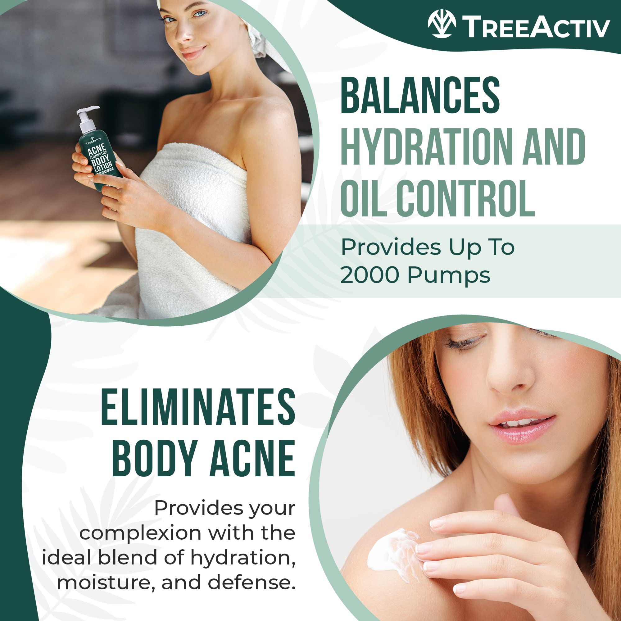 TreeActiv Acne Eliminating Body Lotion 8 oz | Clears Body, Back, Butt & Shoulders | Cucumber Mint