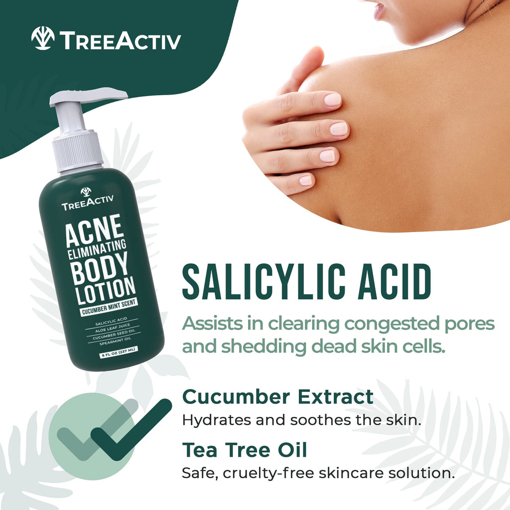 TreeActiv Acne Eliminating Body Lotion 8 oz | Clears Body, Back, Butt & Shoulders | Cucumber Mint
